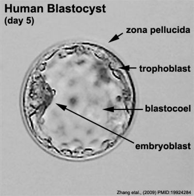 blastocysta - przekrój