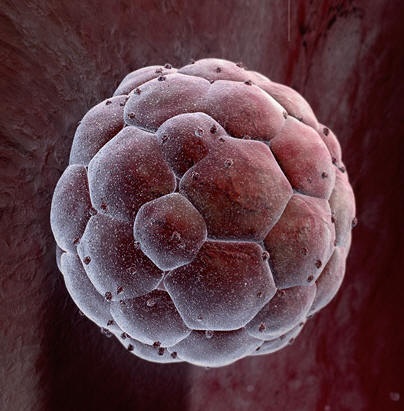 blastocysta: dziecko w 5 dniu życia (0.1-02 mm średnicy)