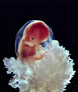 Płód. Autor Lennart Nilsson, Cud życia (Livets mirakel)