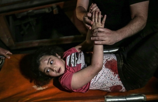 Dziewczynka ranna podczas izraelskiego nalotu w Strefie Gazy, fot. PAP/EPA/MOHAMMED SABER