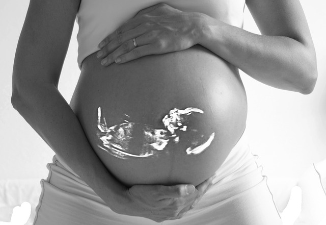 Na Islandii kobiety będą mogły dokonywać aborcji na życzenie do 22. tygodnia ciąży.