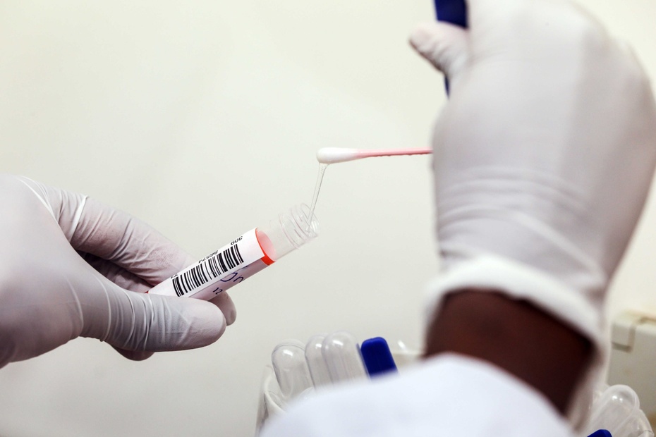Testy na koronawirusa będą szerzej dostępne! Fot. PAP/EPA