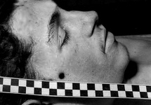 Zdjęcie z sekcji zwłok Antoniego Browarczyka z widoczną kulą w głowie.