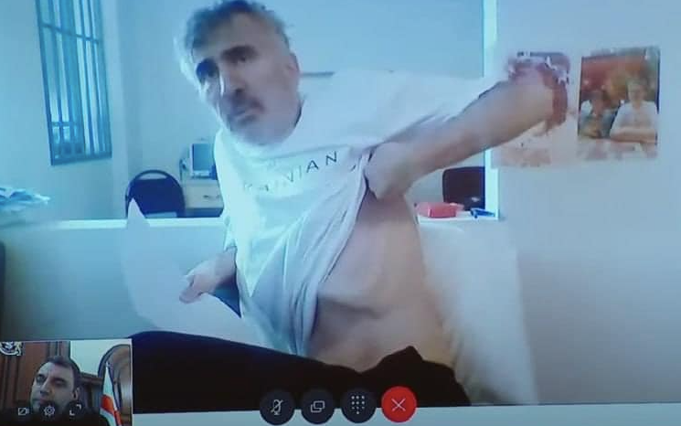 Saakaszwili podciągnął koszulkę podczas rozprawy. Sędzia kazał wyłączyć kamerę