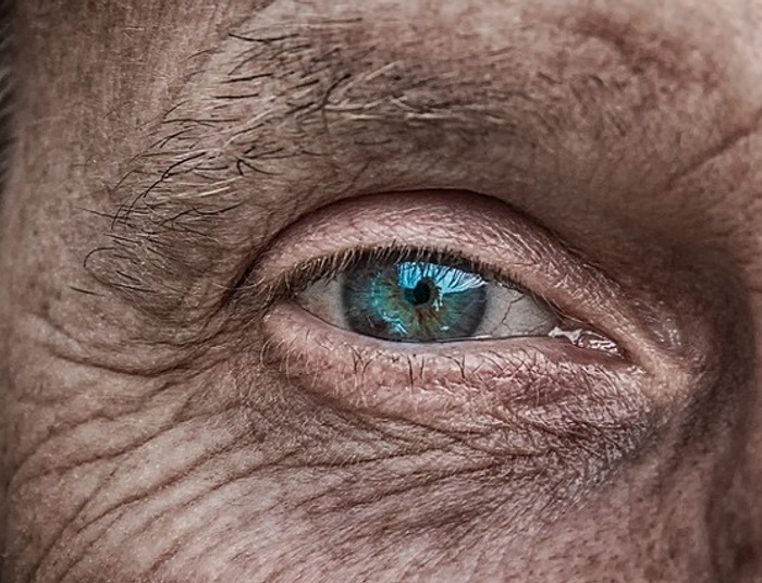 Jaskra - przyczyny i objawy. Światowy Tydzień Jaskry