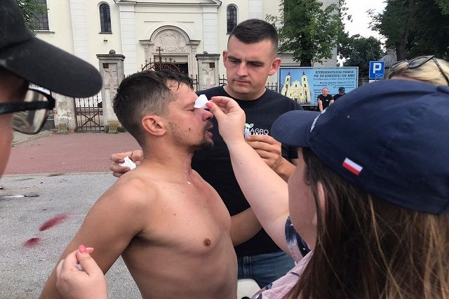 Michał Kołodziejczak dostał gazem w twarz od policjanta w czasie protestu. Fot.: swiatrolnika.info