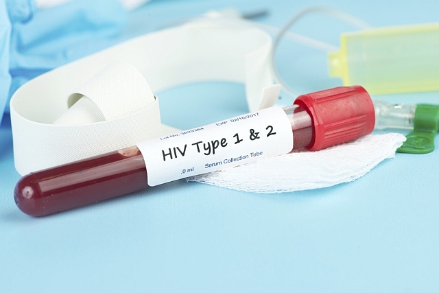 HIV najłatwiej zarazić się przez przygodne kontakty seksualne. Fot. hivequal.org