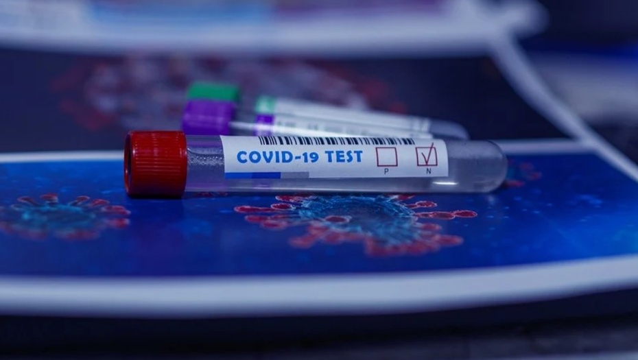 W Polsce stosuje się dwa rodzaje testów na COVID-19: genetyczne i serologiczne. Wyjaśniamy, czym się różnią.