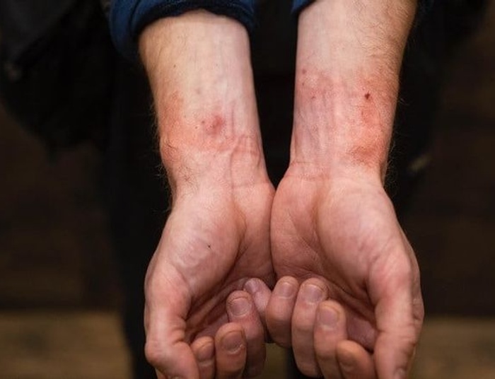 Pogromy dziennikarzy na Podlasiu