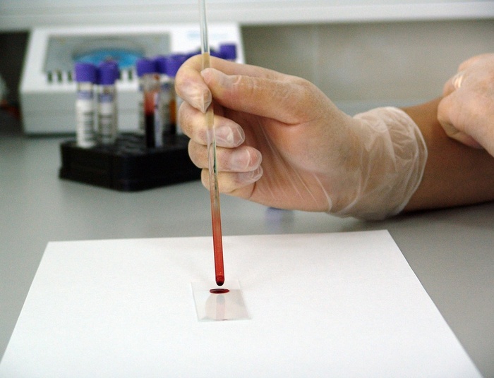 Szpiczak wciąż jest zbyt późno wykrywany