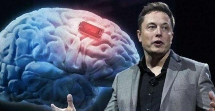 Elon Musk ma zgodę rządu USA na eksperymenty z ludzkim mózgiem.