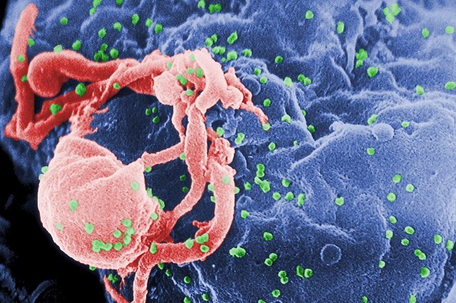 Wirus HIV-1 (na zielono) pod mikroskopem elektronowym. Fot. C. Goldsmith Content Providers