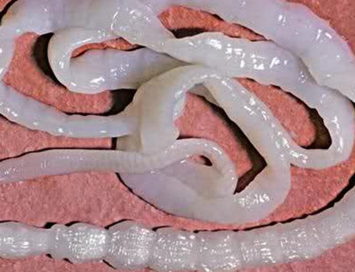 "Dieta" tasiemcowa - wyjątkowo niebezpieczna dla zdrowia